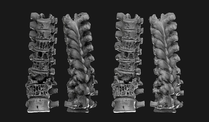 scan cleaning and optimization | Paleopathology | Musée de l’Homme