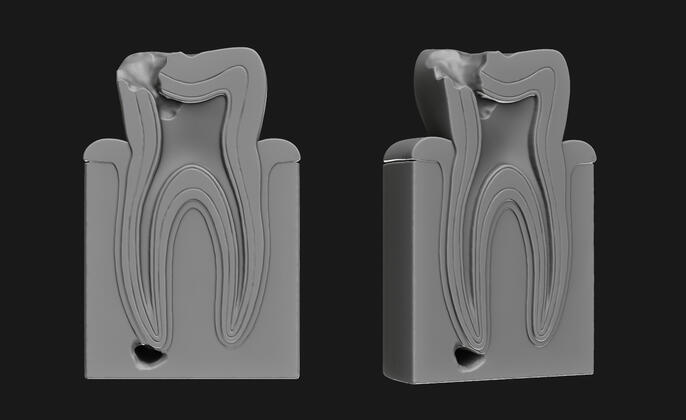 3D modeling for printing | Paleopathology | Musée de l’Homme
